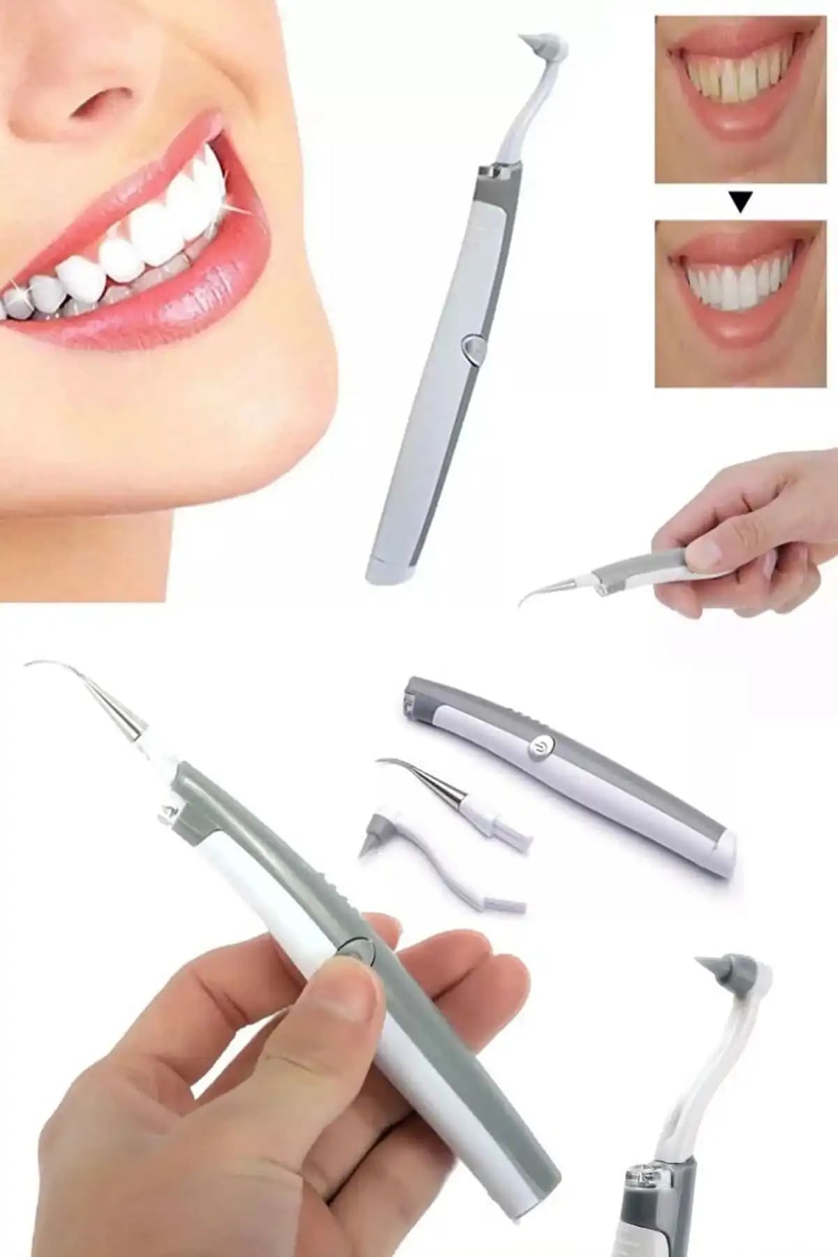 Elektronik Tartara Karşı Çözüm: Sağlıklı Dişler İçin Modern Temizlik Teknolojileri