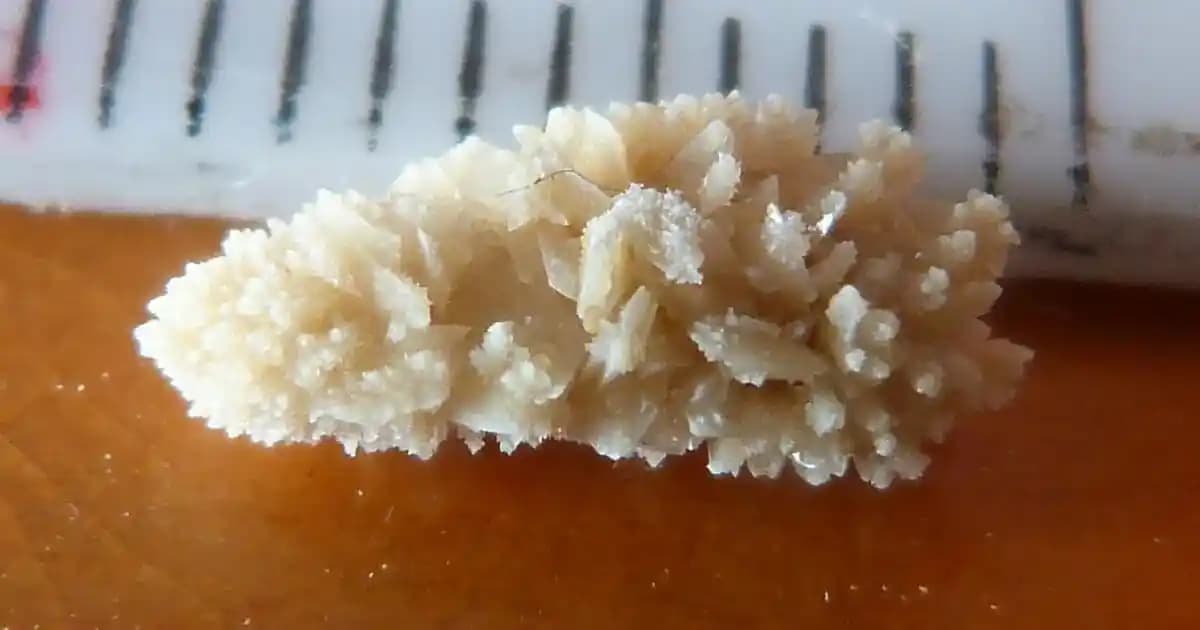 Manyetik Mikro-Robotların Böbrek Taşları Tedavisinde İdrar pH Düzenlemesindeki Rolü